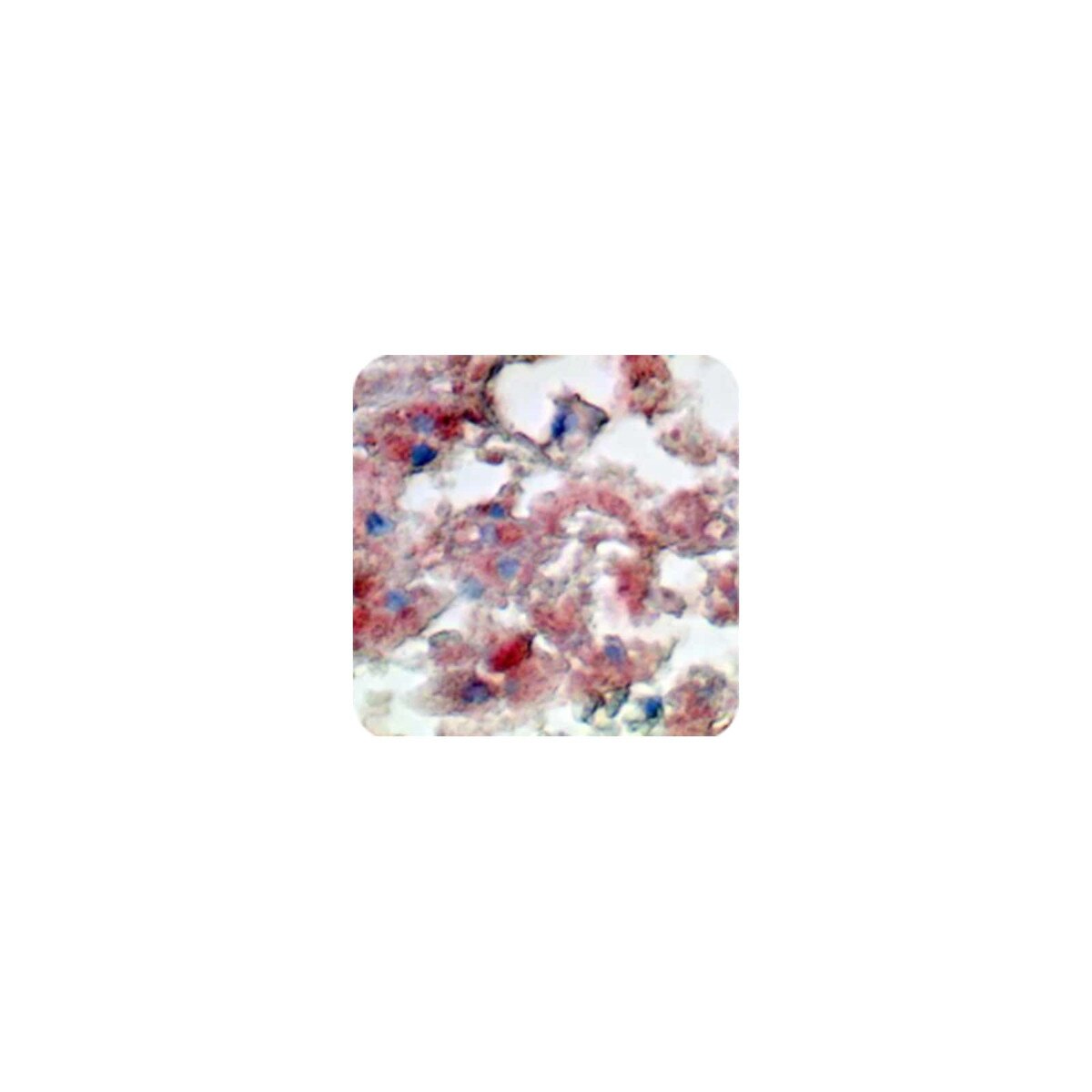 Oil Red O Stain Kit (For Fat)